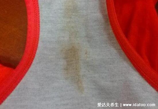 女孩初潮前的白带图片,颜色多为巧克力色伴随有血丝