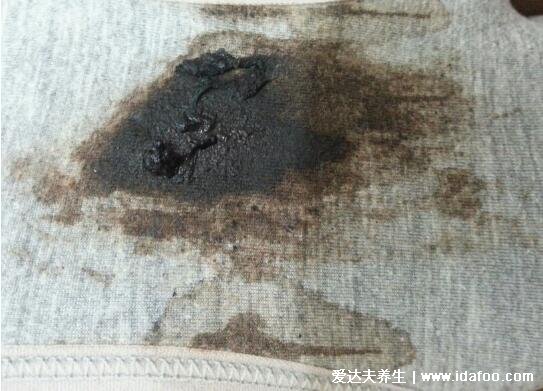 女孩初潮前的白带图片,颜色多为巧克力色伴随有血丝