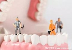 洗牙一次大概多少钱左右,能管多久(一百元