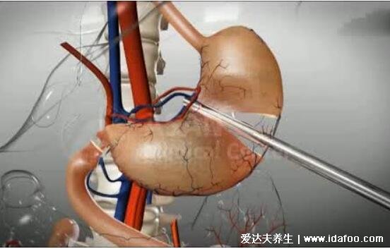 年轻人最好不要做胃镜为谣言,出现这6种状况一定要检查
