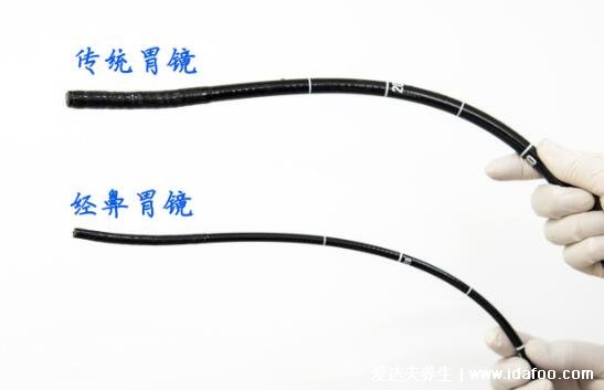 年轻人最好不要做胃镜为谣言,出现这6种状况一定要检查
