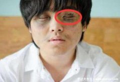 肝脏不好有什么表现症状有哪些,8大症状提