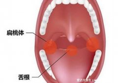 鱼刺卡喉咙怎么办?教大家一个简单的好办法