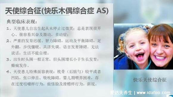 天使综合症是什么病,为快乐木偶综合征永远在笑(附小孩图片)