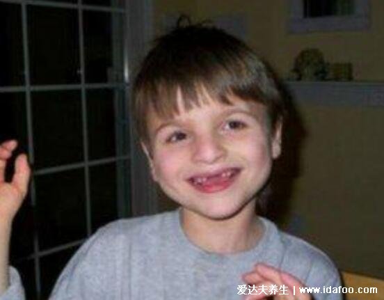 天使综合症是什么病,为快乐木偶综合征永远在笑(附小孩图片)