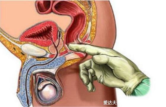 4个最为明显的肠癌信号,大便变细带血不规律都有可能是肠癌