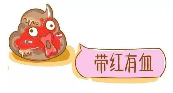4个最为明显的肠癌信号,大便变细带血不规律都有可能是肠癌