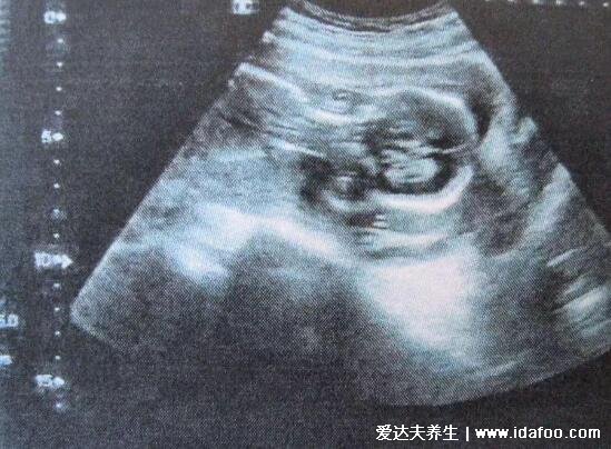 10秒测出怀男孩和女孩的5大方法,可以通过晨尿来判断男女