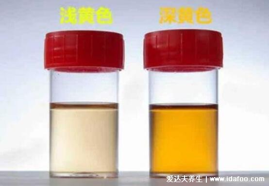 10秒测出怀男孩和女孩的5大方法,可以通过晨尿来判断男女