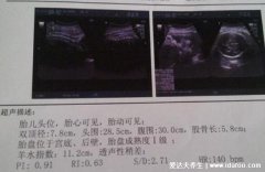 小窍门测男孩还是女孩，自己从B超单也能看