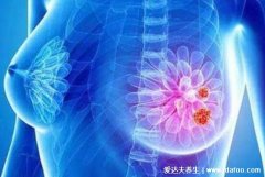 吃三个月逍遥丸治好乳腺结节,为真但是效