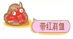 4个最为明显的肠癌信号,大便变细带血不规