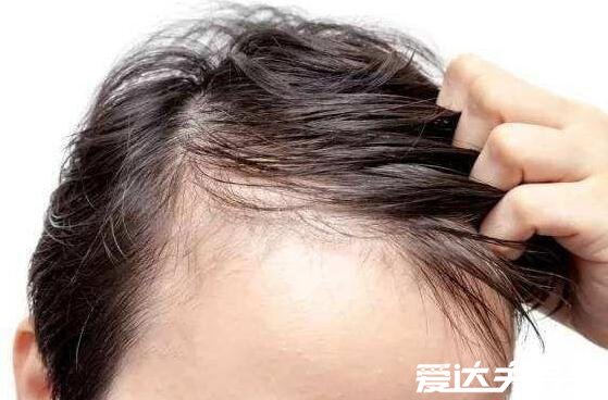 八个方法让头发变浓密,使用气垫按摩梳生发(亲测有效)