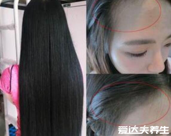 八个方法让头发变浓密,使用气垫按摩梳生发(亲测有效)