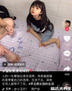 罕见的歌舞伎面谱综合症,长得太好看也是