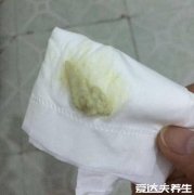 霉菌用手抠出来的图片,呈豆腐渣样分泌物