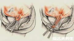 石女是什么意思?为什么不能行房?有真假石女