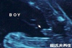 四维单子上有3个亮点是男孩，3条线的可能是