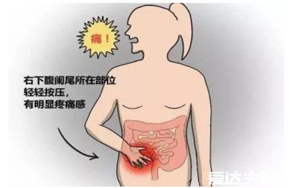 阑尾炎是哪个部位疼,阑尾炎的疼痛位置图片
