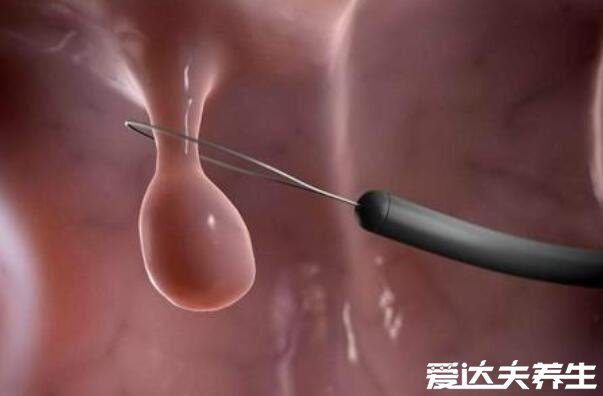 肛门外有个肉疙瘩图片,不一定是痔疮还可能是这四大原因