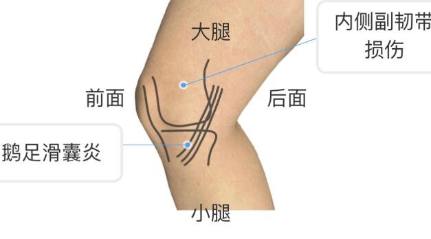 膝盖各个部位疼痛图解,不同位置疼痛代表不同疾病(两侧疼最严重)