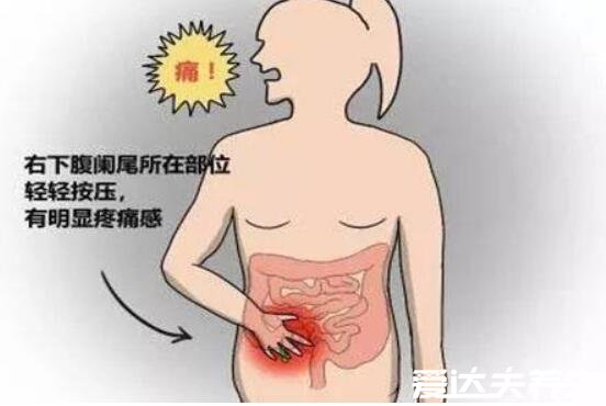 阑尾炎的疼痛位置图片,位于盲肠与回肠之间人体的右下腹处