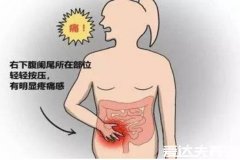 阑尾炎的疼痛位置图片,位于盲肠与回肠之