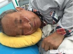 我爸癌症晚期居然好了,原因是自身免疫机