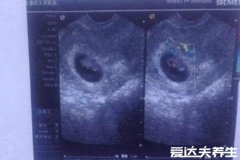 怀男孩很早就有感觉的六大症状,男孩发育