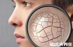 容易静电的人说明什么,可能是皮肤干燥或