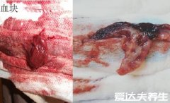 血块和孕囊的区别图,有不溶于水的白色絮