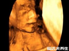 四维彩超多少钱，300-500元不等且安全无害