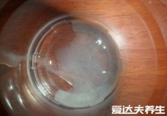 碱性乳白体是什么，指男性精液由精浆和精