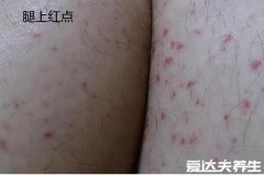 什么样的红点是艾滋病,全身多部位长红色