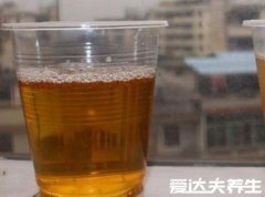 100%生男孩的症状,原来从怀孕的早期便可以