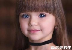 歌舞伎面谱综合征,宝宝的容貌非常漂亮且