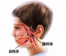 切除腺样体后悔到家了,会导致孩子免疫力