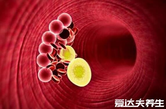 血糖高就是糖尿病吗,造成血糖高的因素很多并不只是糖尿病
