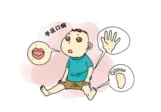 手足口病症状初期图片,如有相似尽快就医(附治疗事项)