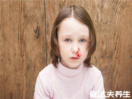 小孩鼻子出血七种原因,别再用错误方法给孩子止血了
