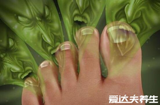 盐水泡脚有什么好处,消炎杀菌多年脚气有救了