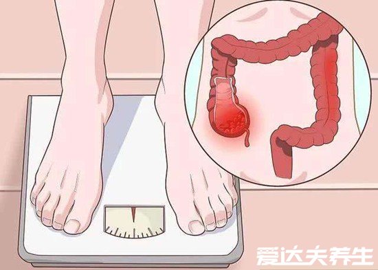 4个最为明显的肠癌信号预警,大便问题可不只是消化不良