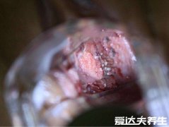 感染女性hpv真实图片,80%人会感染hpv但没必