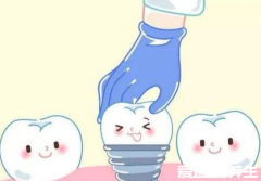 千万不要种植牙，关于种植牙你必须要知道