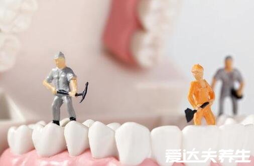 为什么医生不推荐洗牙,这三类人要注意千万不能洗牙