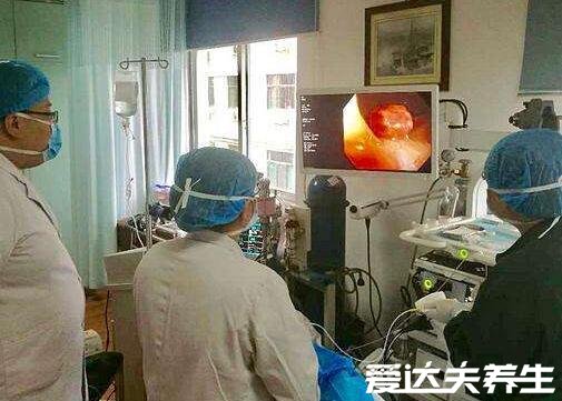 做了无痛肠镜很后悔,为什么没有早点去做检查