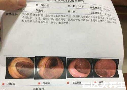 做了无痛肠镜很后悔,为什么没有早点去做检查