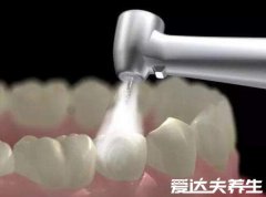 为什么医生不推荐洗牙,这三类人要注意千