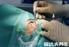 做完近视手术后悔死了，不适合做近视手术