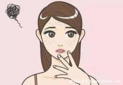 祛斑最有效的8个偏方,日常祛斑可以试试苹